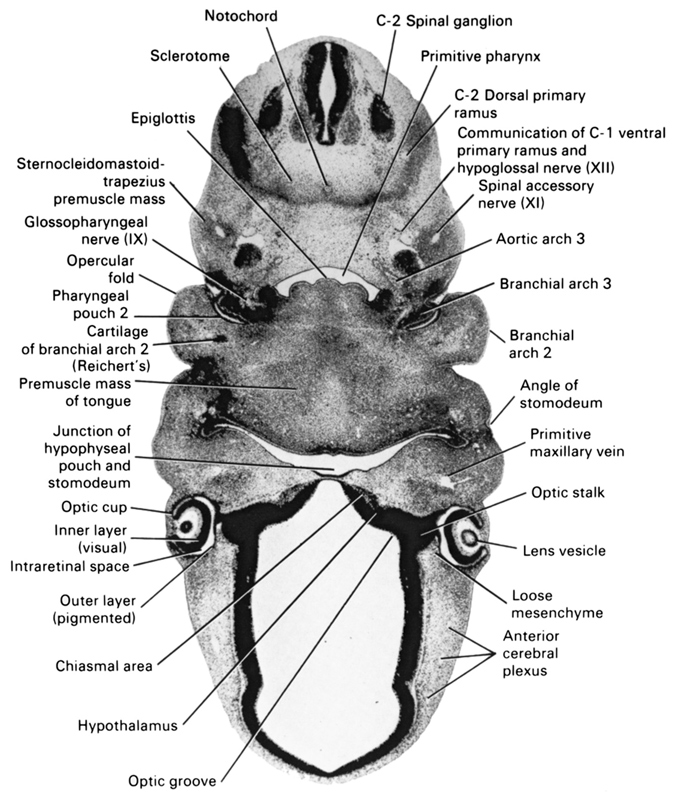 C-2 dorsal primary ramus, C-2 spinal ganglion, angle of stomodeum, anterior cerebral plexus, aortic arch 3, branchial arch 2, branchial arch 3, cartilage of branchial arch 2 (Reichert's), chiasmal area, communication of C-1 ventral primary ramus and hypoglossal nerve (CN XII), epiglottis, glossopharyngeal nerve (CN IX), hypothalamus, inner layer (visual), intraretinal space (optic vesicle cavity), junction of hypophyseal pouch and stomodeum, lens vesicle, loose mesenchyme, notochord, opercular fold, optic cup, optic groove, optic stalk, outer layer (pigmented), pharyngeal pouch 2, premuscle mass of tongue, primitive maxillary vein, primitive pharynx, sclerotome, spinal accessory nerve (CN XI), sternocleidomastoid / trapezius premuscle mass