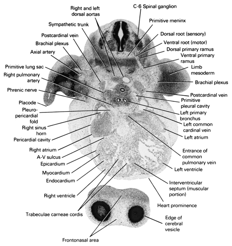 C-6 spinal ganglion, atrioventricular sulcus, axial artery, brachial plexus, dorsal primary ramus, dorsal root (sensory), edge of cerebral vesicle(s), endocardium, entrance of common pulmonary vein, epicardium, frontonasal area, heart prominence, interventricular septum (muscular portion), left atrium, left common cardinal vein, left primary bronchus, left ventricle, limb mesoderm, myocardium, pericardial cavity, phrenic nerve, placode, pleuropericardial fold, postcardinal vein, primitive lung sac, primitive meninx, primitive pleural cavity, right and left dorsal aortas, right atrium, right horn of sinus venosus, right pulmonary artery, right ventricle, sympathetic trunk, trabeculae carneae cordis, ventral primary ramus, ventral root (motor)