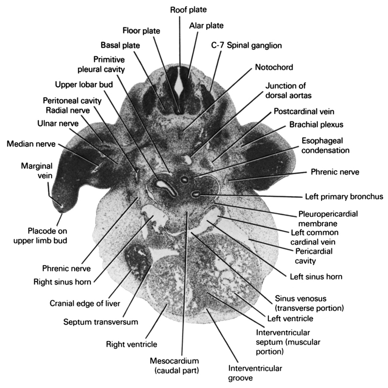 C-7 spinal ganglion, alar plate(s), basal plate, brachial plexus, cranial edge of liver, esophageal condensation, floor plate, interventricular groove, interventricular septum (muscular portion), junction of dorsal aortas, left common cardinal vein, left horn of sinus venosus, left primary bronchus, left ventricle, marginal vein, median nerve, mesocardium (caudal part), notochord, pericardial cavity, peritoneal cavity, phrenic nerve, placode on upper limb bud, pleuropericardial membrane, postcardinal vein, primitive pleural cavity, radial nerve, right horn of sinus venosus, right ventricle, roof plate, septum transversum, sinus venosus (transverse portion), ulnar nerve, upper lobar bud 