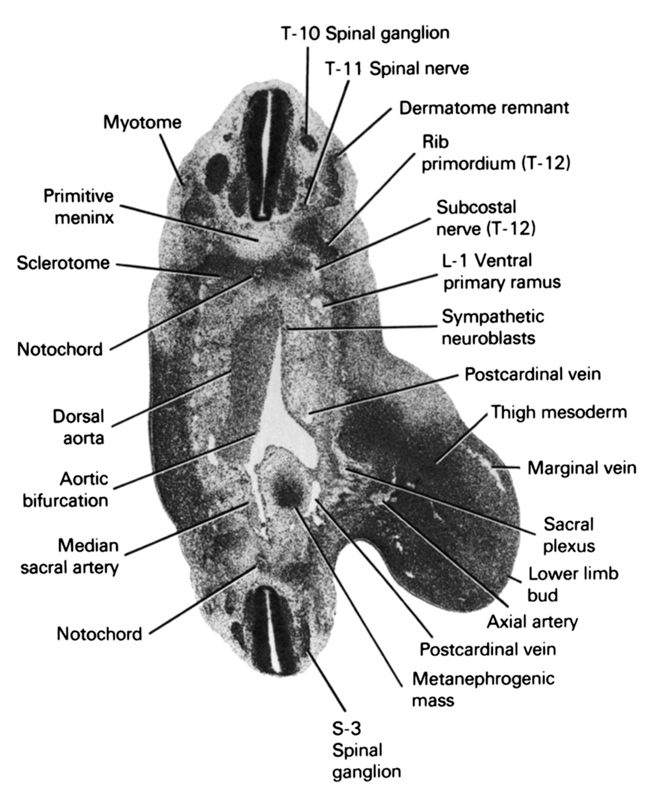 L-1 ventral primary ramus, S-3 spinal ganglion, T-10 spinal ganglion, T-11 spinal nerve, aortic bifurcation, axial artery, dermatome remnant, dorsal aorta, lower limb bud, marginal vein, median sacral artery, metanephrogenic mass, myotome, notochord, postcardinal vein, primitive meninx, rib primordium (T-12), sacral plexus, sclerotome, subcostal nerve (T-12), sympathetic neuroblasts, thigh mesoderm