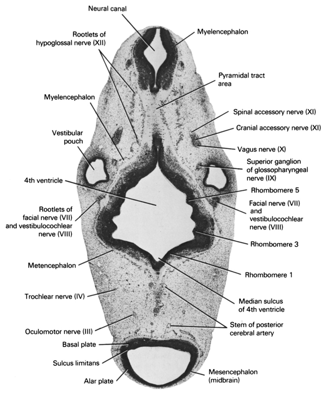 alar plate(s), basal plate, cranial accessory nerve (CN XI), facial nerve (CN VII) and vestibulocochlear nerve (CN VIII) , median sulcus of 4th ventricle, mesencephalon (midbrain), metencephalon, myelencephalon, neural canal, oculomotor nerve (CN III), pyramidal tract area, rhombencoel (fourth ventricle), rhombomere 1, rhombomere 3, rhombomere 5, root of facial nerve (CN VII), root of hypoglossal nerve (CN XII), root of vestibulocochlear nerve (CN VIII), spinal accessory nerve (CN XI), stem of posterior cerebral artery, sulcus limitans, superior ganglion of glossopharyngeal nerve (CN IX), trochlear nerve (CN IV), vagus nerve (CN X), vestibular pouch