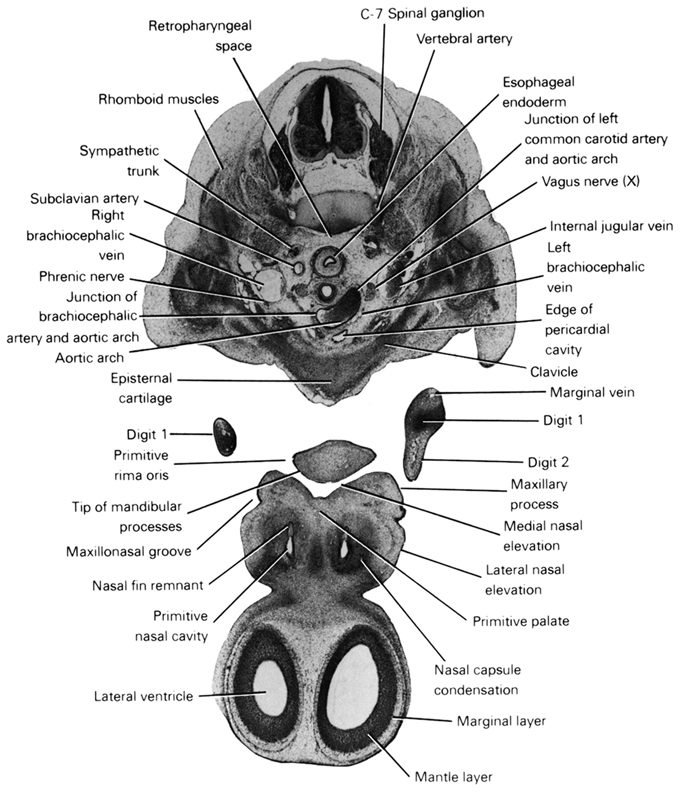 C-7 spinal ganglion, arch of aorta, clavicle, digit 1, digit 2, edge of pericardial cavity, episternal cartilage, esophageal endoderm, internal jugular vein, junction of brachiocephalic artery and aortic arch, junction of left common carotid artery and aortic arch, lateral nasal elevation, lateral ventricle, left brachiocephalic vein, mantle layer, marginal layer, marginal vein, maxillary prominence of pharyngeal arch 1, maxillonasal groove, medial nasal elevation, nasal capsule condensation, nasal fin remnant, phrenic nerve, primitive nasal cavity, primitive palate, primitive rima oris, retropharyngeal space, rhomboid muscles, right brachiocephalic vein, subclavian artery, sympathetic trunk, tip of mandibular processes, vagus nerve (CN X), vertebral artery