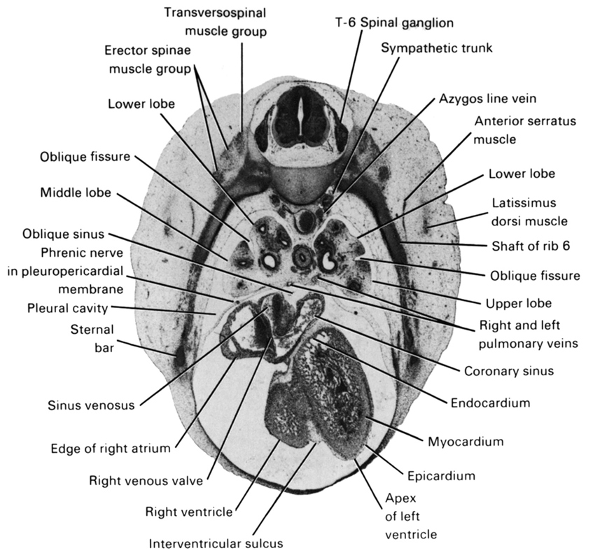 T-6 spinal ganglion, anterior serratus muscle, apex of left ventricle, azygos vein, coronary sinus, edge of right atrium, endocardium, epicardium, erector spinae muscle group, interventricular sulcus, latissimus dorsi muscle, lower lobe, middle lobe, myocardium, oblique fissure, oblique sinus, phrenic nerve in pleuropericardial membrane, pleural cavity, right and left pulmonary veins, right venous valve, right ventricle, shaft of rib 6, sinus venosus, sternal bar, sympathetic trunk, transversospinal muscle group, upper lobe