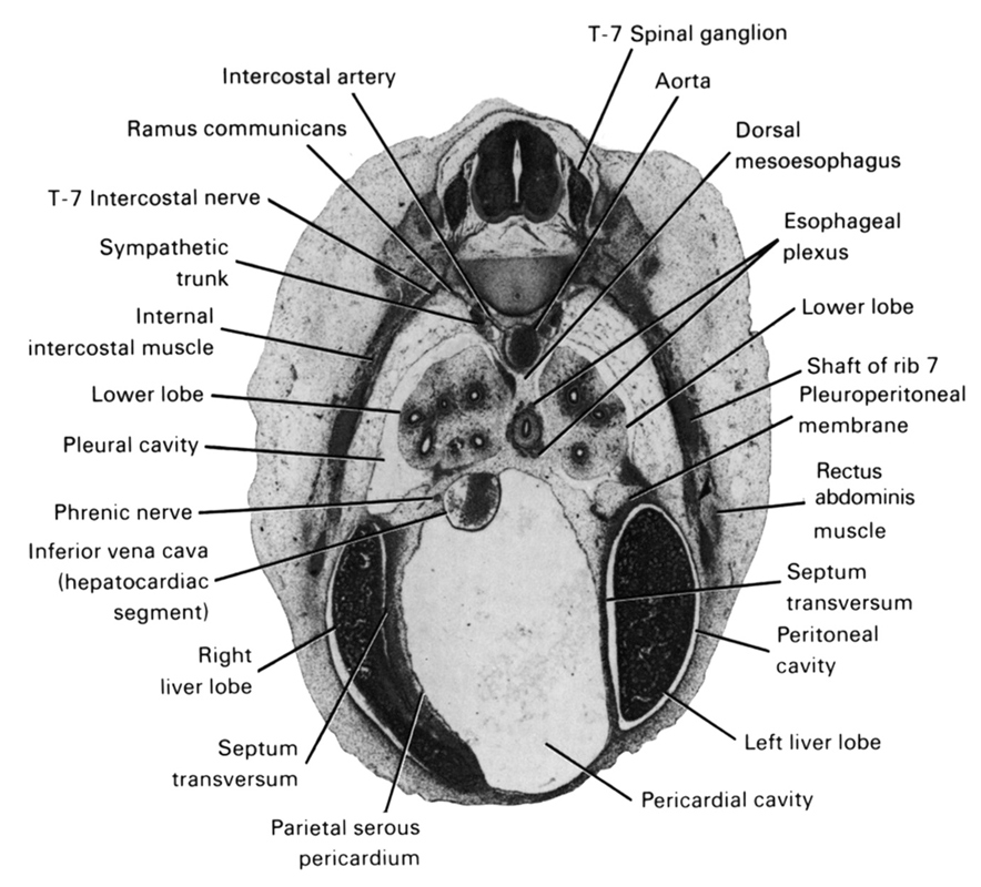 T-7 intercostal nerve, T-7 spinal ganglion, aorta, dorsal meso-esophagus, esophageal plexus, inferior vena cava (hepatocardiac segment), intercostal artery, internal intercostal muscle(s), left lobe of liver, lower lobe, parietal serous pericardium, pericardial cavity, peritoneal cavity, phrenic nerve, pleural cavity, pleuroperitoneal membrane, ramus communicans, rectus abdominis muscle, right lobe of liver, septum transversum, shaft of rib 7, sympathetic trunk