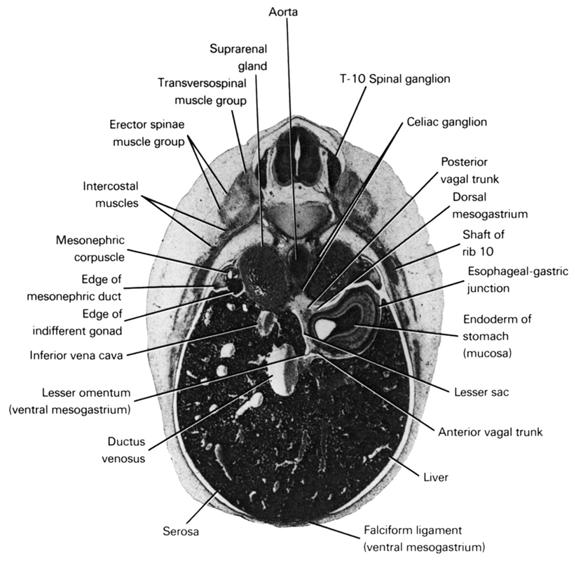 T-10 spinal ganglion, celiac ganglion, dorsal mesogastrium, posterior vagal trunk, shaft of rib 10