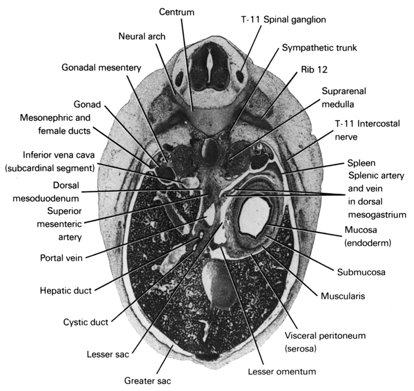 T-11 intercostal nerve, T-11 spinal ganglion, centrum, cystic duct, dorsal mesoduodenum, gonad, gonadal mesentery, greater sac, hepatic duct(s), inferior vena cava (subcardinal vein), lesser omentum, lesser sac, mesonephric and female ducts, mucosa (endoderm), muscularis, neural arch, portal vein, rib 12, spleen, splenic artery and vein in dorsal mesogastrium, submucosa, superior mesenteric artery, suprarenal medulla, sympathetic trunk, visceral peritoneum (serosa)