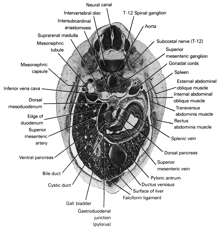 T-12 spinal ganglion, aorta, bile duct, cystic duct, dorsal mesoduodenum, dorsal pancreas, ductus venosus, edge of duodenum, external abdominal oblique muscle, falciform ligament, gall bladder, gastroduodenal junction (pylorus), gonadal cords, inferior vena cava, internal abdominal oblique muscle, intersubcardinal anastomosis, intervertebral disc, mesonephric capsule, mesonephric tubule(s), neural canal, pyloric antrum, rectus abdominis muscle, spleen, splenic vein, subcostal nerve (T-12), superior mesenteric artery, superior mesenteric ganglion, superior mesenteric vein, suprarenal medulla, surface of liver, transversus abdominis muscle, ventral pancreas