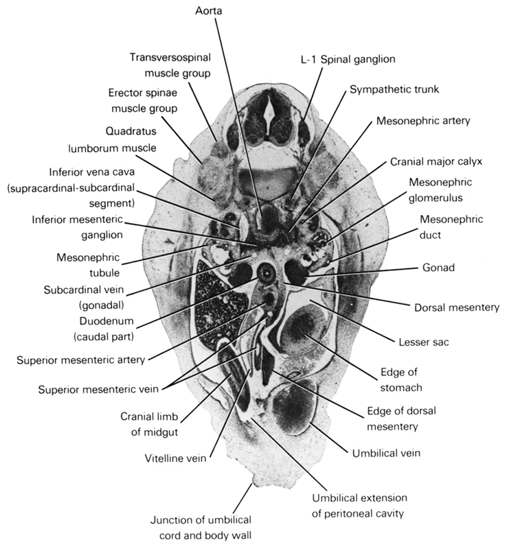 L-1 spinal ganglion, aorta, cranial limb of midgut, cranial major calyx, dorsal mesentery, duodenum (caudal part), edge of dorsal mesentery, edge of stomach, erector spinae muscle group, gonad, inferior mesenteric ganglion, inferior vena cava (supracardinal-subcardinal segment), junction of umbilical cord and body wall, lesser sac, mesonephric artery, mesonephric duct, mesonephric glomerulus, mesonephric tubule(s), quadratus lumborum muscle, subcardinal vein (gonadal), superior mesenteric artery, superior mesenteric vein, sympathetic trunk, transversospinal muscle group, umbilical extension of peritoneal cavity, umbilical vein, vitelline (omphalomesenteric) vein