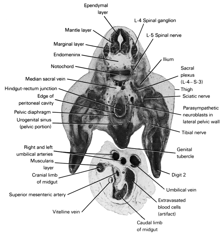 L-4 spinal ganglion, L-5 spinal nerve, caudal limb of midgut, cranial limb of midgut, digit 2, edge of peritoneal cavity, endomeninx, ependymal layer, extravasated blood cells (artifact), genital tubercle, hindgut-rectum junction, ilium, mantle layer, marginal layer, median sacral vein, muscularis layer, notochord, parasympathetic neuroblasts in lateral pelvic wall, pelvic diaphragm, right and left umbilical arteries, sacral plexus (L-4 - S-3), sciatic nerve, superior mesenteric artery, thigh, tibial nerve, umbilical vein, urogenital sinus (pelvic portion), vitelline (omphalomesenteric) vein