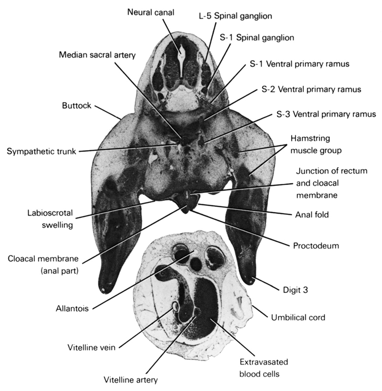 L-5 spinal ganglion, S-1 spinal nerve, S-1 ventral primary ramus, S-2 ventral primary ramus, S-3 ventral primary ramus, allantois, anal fold, buttock, cloacal membrane (anal part), digit 3, extravasated blood cells, hamstring muscle group, junction of rectum and cloacal membrane, labioscrotal swelling, median sacral artery, neural canal, proctodeum, sympathetic trunk, umbilical cord, vitelline (omphalomesenteric) artery, vitelline (omphalomesenteric) vein