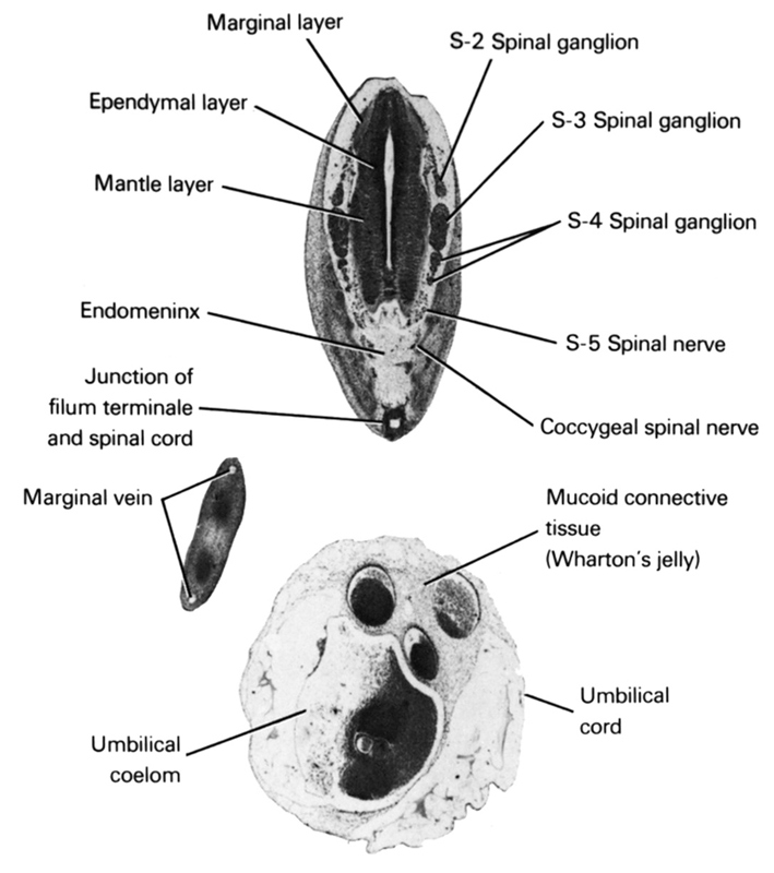 S-2 spinal ganglion, S-3 spinal ganglion, S-4 spinal ganglion, S-5 spinal nerve, coccygeal spinal nerve, endomeninx, ependymal layer, junction of filum terminale and spinal cord, mantle layer, marginal layer, marginal vein, umbilical coelom, umbilical cord