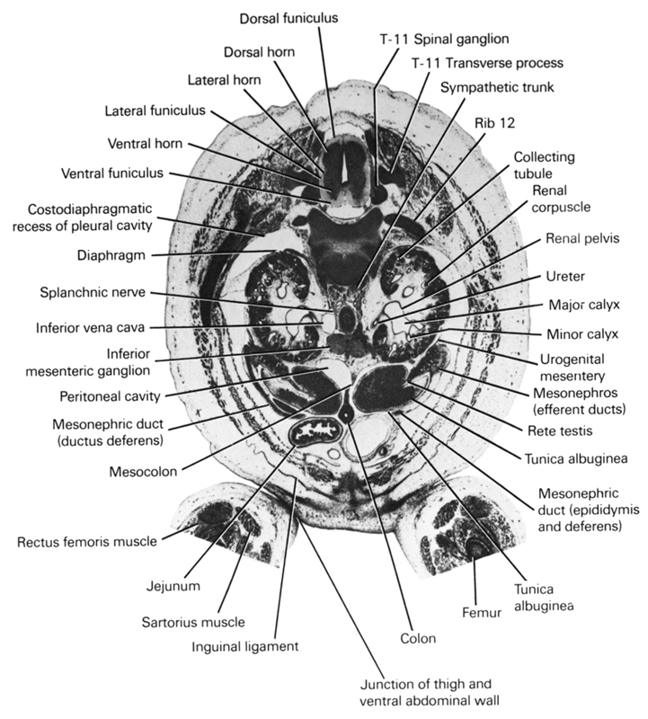 T-11 spinal ganglion, T-11 transverse process, collecting tubule, colon, costodiaphragmatic recess of pleural cavity, diaphragm, dorsal funiculus, dorsal horn, femur, inferior mesenteric ganglion, inferior vena cava, inguinal ligament, jejunum, junction of thigh and ventral abdominal wall, lateral funiculus, lateral horn, major calyx, mesocolon, mesonephric duct (ductus deferens), mesonephric duct (epididymis and deferens), mesonephros (efferent ducts), minor calyx, peritoneal cavity, rectus femoris muscle, renal corpuscle, renal pelvis, rete testis, rib 12, sartorius muscle, splanchnic nerve, sympathetic trunk, tunica albuginea, ureter, urogenital mesentery, ventral funiculus, ventral horn