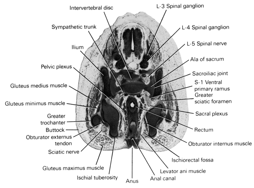 L-3 spinal ganglion, L-4 spinal ganglion, L-5 spinal nerve, S-1 ventral primary ramus, ala of sacrum, anal canal, anus, buttock, gluteus maximus muscle, gluteus medius muscle, gluteus minimus muscle, greater sciatic foramen, greater trochanter, ilium, intervertebral disc, ischial tuberosity, ischiorectal fossa, levator ani muscle, obturator externus muscle, obturator internus muscle, pelvic plexus, rectum, sacral plexus, sacro-iliac joint, sciatic nerve, sympathetic trunk