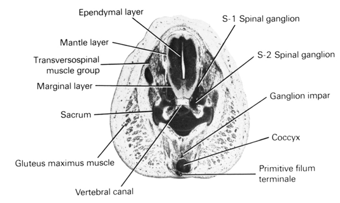S-1 spinal ganglion, S-2 spinal ganglion, coccyx, ependymal layer, ganglion impar, gluteus maximus muscle, mantle layer, marginal layer, primitive filum terminale, sacrum, transversopinal muscle group, vertebral canal