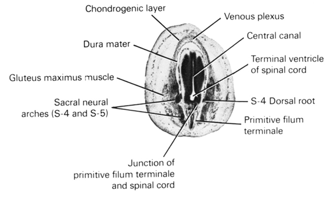 S-4 dorsal root, central canal, chondrogenic layer, dura mater, gluteus maximus muscle, junction of primitive filum terminale and spinal cord, primitive filum terminale, sacral neural arches (S-4 and S-5), terminal ventricle of spinal cord, venous plexus(es)