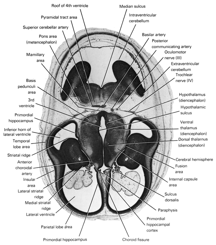 anterior choroidal artery, basilar artery, basis pedunculi area, cerebral hemisphere, choroid fissure, diencoel (third ventricle), dorsal thalamus (diencephalon), extraventricular cerebellum, fusion area, hypothalamic sulcus, hypothalamus (diencephalon), inferior horn of lateral ventricle, insular area, internal capsule area, intraventricular cerebellum, lateral striatal ridge, lateral ventricle, mamillary area, medial striatal ridge, median sulcus, oculomotor nerve (CN III), paraphysis, parietal lobe area, pons region (metencephalon), posterior communicating artery, primordial hippocampal cortex, primordial hippocampus, pyramidal tract area, roof of rhombencoel (fourth ventricle), striatal ridge, sulcus dorsalis, superior cerebellar artery, temporal lobe area, trochlear nerve (CN IV), ventral thalamus (diencephalon)