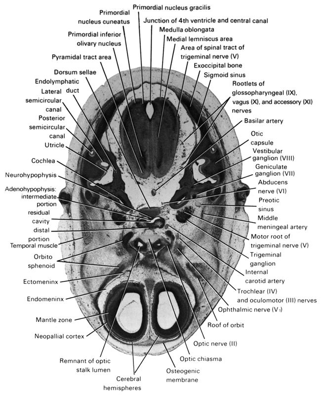 abducens nerve (CN VI), adenohypophysis (intermediate part), adenohypophysis (residual cavity), area of spinal tract of trigeminal nerve (CN V), basilar artery, cerebral hemisphere, cochlea, distal part of adenohypophysis, dorsum sellae, ectomeninx, endolymphatic duct, endomeninx, exoccipital bone, geniculate ganglion (CN VII), internal carotid artery, junction of rhombocoel (fourth ventricle) and surface ectoderm, lateral semicircular canal, mantle zone, medial lemniscus area, medulla oblongata, middle meningeal artery, motor root of trigeminal nerve (CN V), neopallial cortex, neurohypophysis, oculomotor nerve (CN III), ophthalmic nerve (CN V₁), optic chiasma, optic nerve (CN II), orbitosphenoid, osteogenic membrane, otic capsule, posterior semicircular canal, pre-otic sinus, primordial inferior olivary nucleus, primordial nucleus cuneatus, primordial nucleus gracilis, pyramidal tract area, remnant of optic stalk lumen, roof of orbit, root of accessory nerve (CN XI), root of glossopharyngeal nerve (CN IX), root of vagus nerve (CN X), sigmoid sinus, temporalis muscle, trigeminal ganglion (CN V), trochlear nerve (CN IV), utricle, vestibulocochlear ganglion (CN VIII)