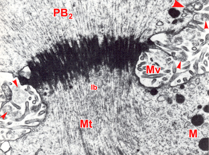 Area between the abstracted second polar body