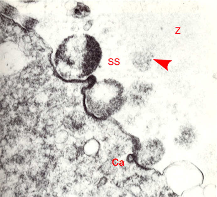 Delayed release of cortical granules into the subzonal space