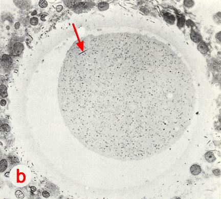 High power LM of section through the fertilization cone