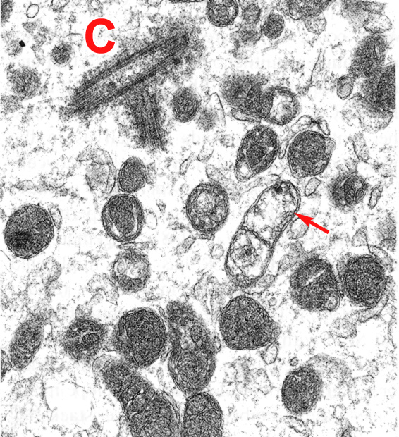 Detail of sperm mitochondria