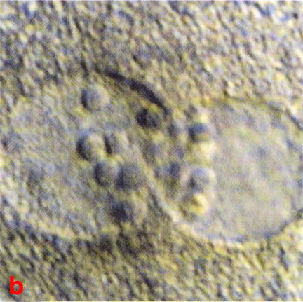 Close up view of pronuclei showing nucleolar distribution