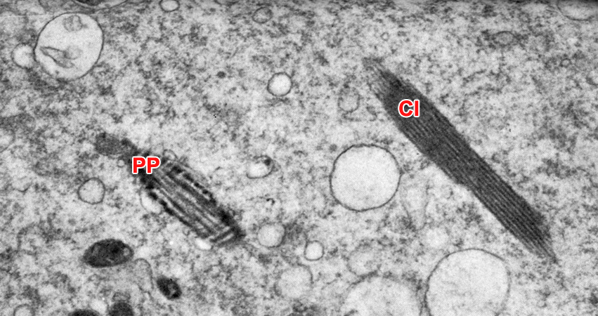 High power TEM of the cytoplasm