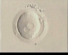 Adjacent Pronuclei