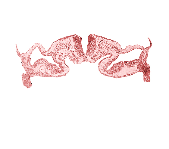 midgut, presumptive right atrium, primordial peritoneal cavity, surface ectoderm, umbilical vesicle cavity