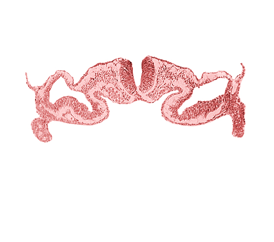 artifact separation(s), dorsal aorta, intermediate mesenchyme, midgut, neural fold [rhombencephalon (Rh. C)], paraxial mesoderm, presumptive right atrium, primordial peritoneal cavity, somatopleure, surface ectoderm, umbilical vesicle cavity