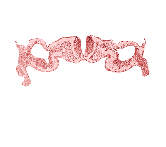 alar plate(s), basal plate, dorsal aorta, dorsal intersegmental artery, midgut, primordial peritoneal cavity, sulcus limitans, umbilical vesicle wall