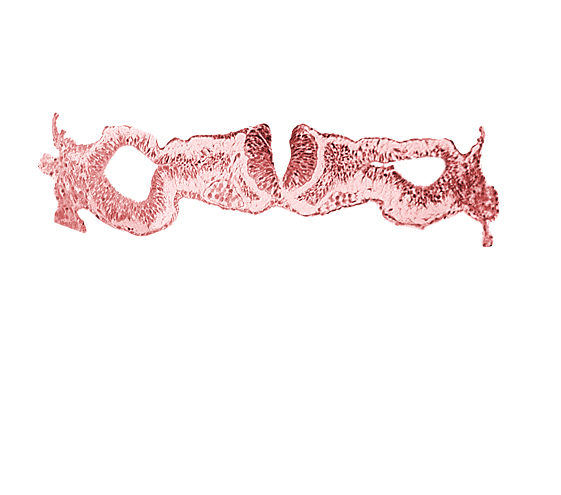 cephalic neuropore, dorsal aorta, intermediate mesenchyme, notochordal plate, primordial peritoneal cavity, sclerotomal cells, somatopleuric mesoderm, somite 1 (O-1), splanchnopleuric mesoderm