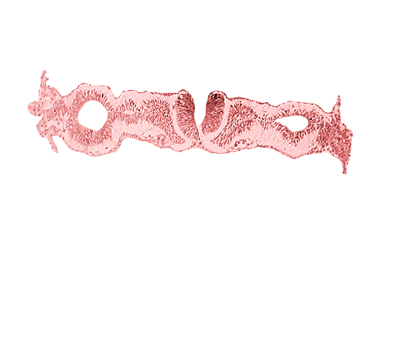 alar plate(s), basal plate, dorsal aorta, notochordal plate, primordial peritoneal cavity, somitocoel 1, sulcus limitans