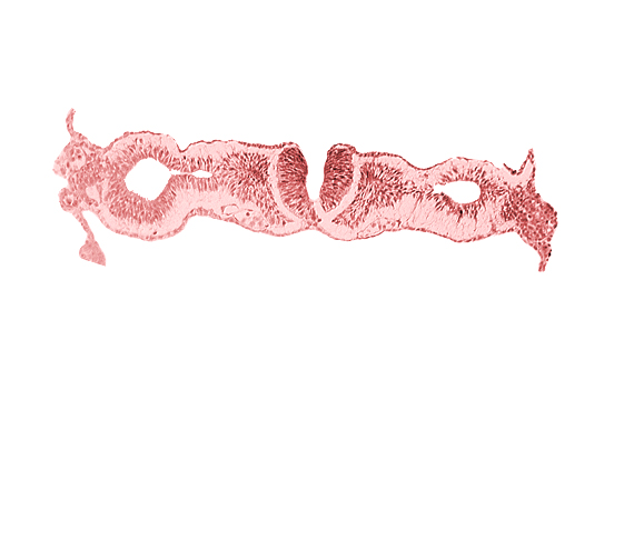 artifact separation(s), dorsal aorta, midgut, neural fold [rhombencephalon (Rh. D)], primordial peritoneal cavity, somite 1 (O-1)