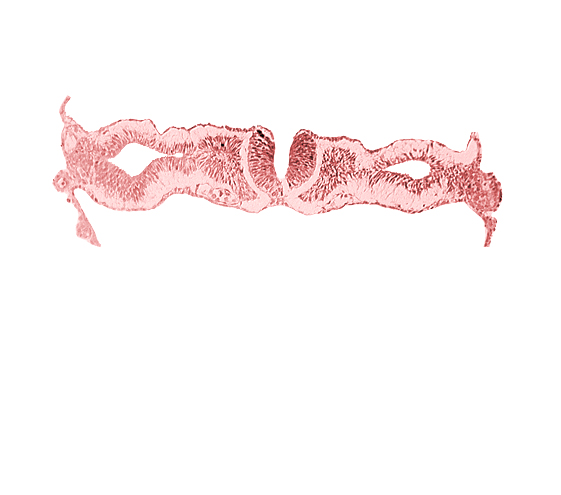 artifact separation(s), cephalic neuropore, dorsal aorta, primordial peritoneal cavity, somite 1 (O-1)