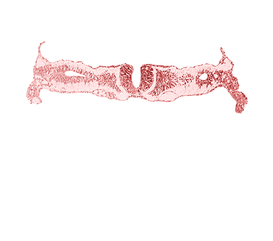 dorsal aorta, midgut, nephrogenic cord, neural fold [rhombencephalon (Rh. D)], primordial peritoneal cavity, right umbilical vein, somitocoel 2