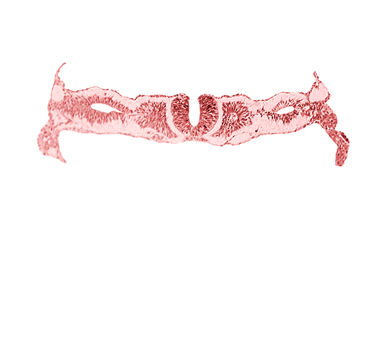 cephalic neuropore, dorsal aorta, nephrogenic cord, neural fold [rhombencephalon (Rh. D)], primordial peritoneal cavity, right umbilical vein, somite 2 (O-2), somitocoel 2