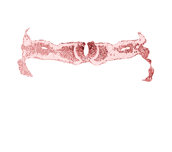 amnion, caudal edge of cephalic neuropore, neural fold [rhombencephalon (Rh. D)], notochordal plate, primordial peritoneal cavity, right umbilical vein, somite 2 (O-2), umbilical vesicle wall