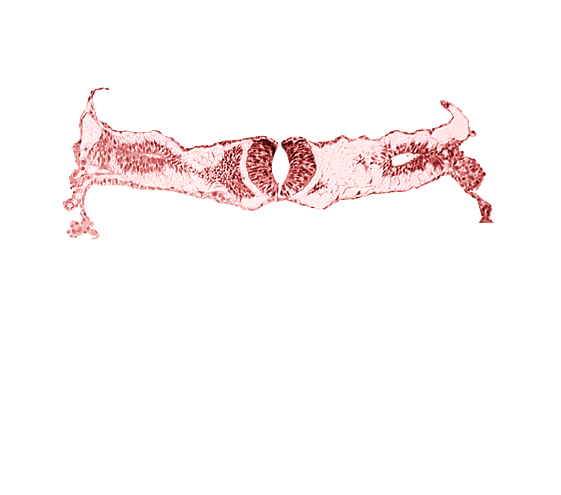 junction area of neural folds [rhombencephalon (Rh. D)], notochordal plate, primordial peritoneal cavity, somite 2-3 intersegmental region