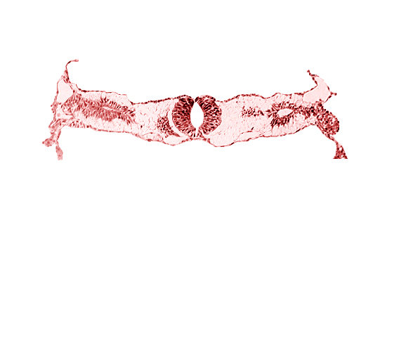 cephalic edge of neural tube, cephalic edge of somite 3 (O-3), fusing neural folds [rhombencephalon (Rh. D)], midgut, primordial peritoneal cavity, surface ectoderm