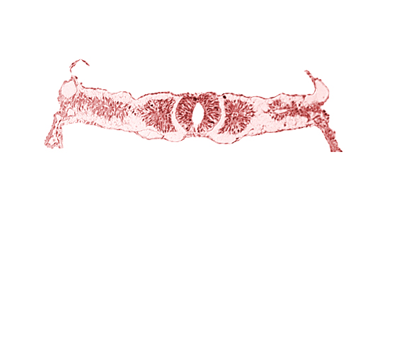 amnion attachment, dorsal aorta, endoderm, midgut, somite 3 (O-3), somitocoel 3, sulcus limitans, surface ectoderm, umbilical vesicle wall