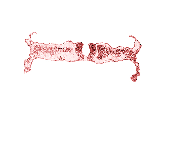 amniotic cavity, artifact separation(s), extra-embryonic coelom, intermediate mesenchyme, midgut, primordial peritoneal cavity, somite 5 (C-1), umbilical vesicle cavity