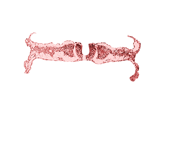 amniotic cavity, artifact separation(s), extra-embryonic coelom, intermediate mesenchyme, midgut, primordial peritoneal cavity, somite 5 (C-1), umbilical vesicle cavity