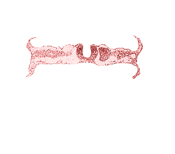 amnion attachment, amniotic cavity, caudal neuropore, dorsal aorta, extra-embryonic coelom, midgut, nephrogenic cord, right umbilical vein, somite 6 (C-2), somitocoel 6, umbilical vesicle cavity, umbilical vesicle wall