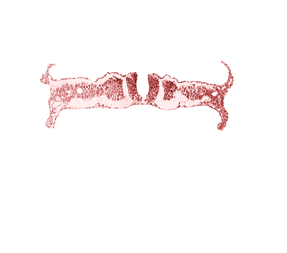 amnion, nephrogenic cord, notochordal plate, primordial peritoneal cavity, right umbilical vein, somite 6 (C-2), umbilical vesicle wall