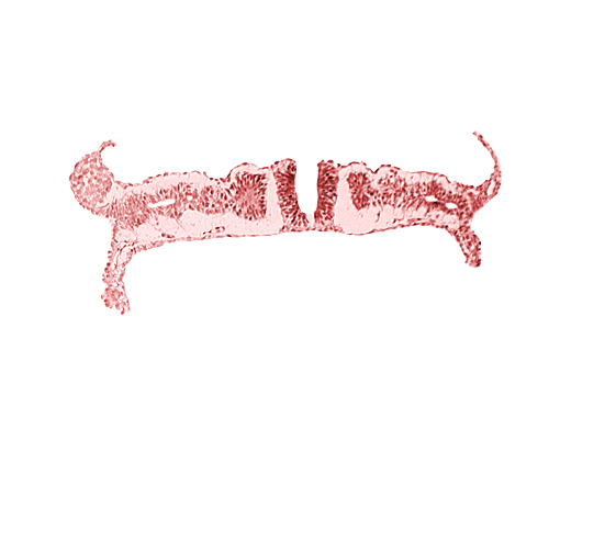 dorsal aorta, nephrogenic cord, somite 7 (C-3)