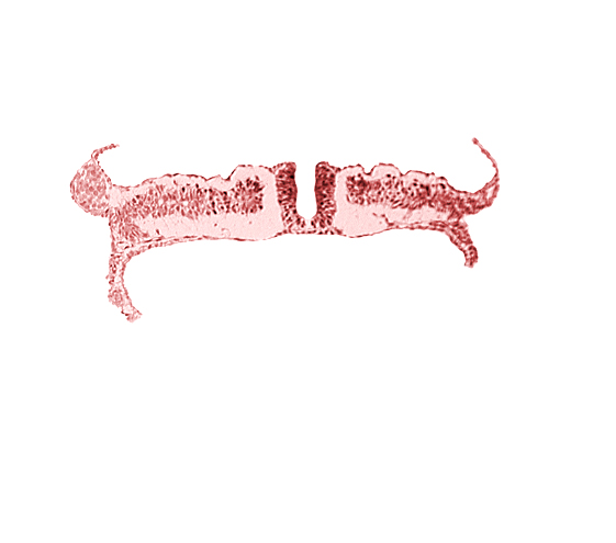 amnion attachment, amniotic cavity, caudal edge of somite 7 (C-3), caudal neuropore, endoderm, extra-embryonic coelom, extra-embryonic mesoderm, midgut, umbilical vesicle cavity, umbilical vesicle wall