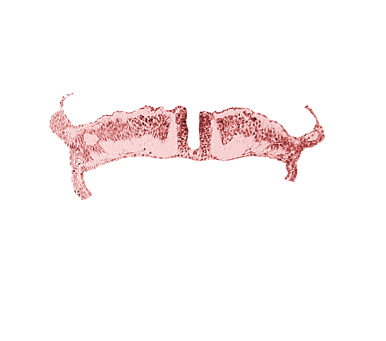 caudal neuropore, dorsal aorta, lateral plate mesoderm, paraxial mesoderm