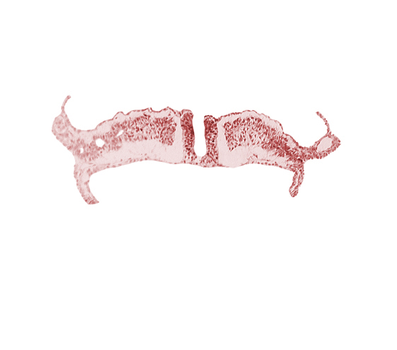 endoderm, intermediate mesenchyme, paraxial mesoderm, primordial peritoneal cavity, somatopleuric mesoderm, splanchnopleuric mesoderm, surface ectoderm