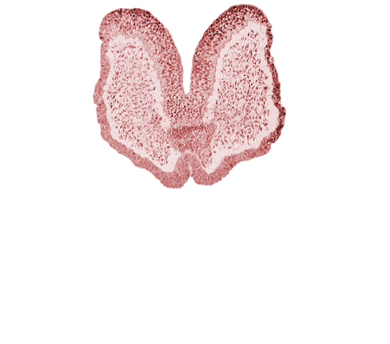 adenohypophysial primordium, artifact space(s), caudal edge of chiasmatic plate (D1), cephalic edge of aortic arch 1, head mesenchyme, neural fold [primordial diencephalon (D2)], neural groove, neurohypophysial primordium, prechordal plate (oropharyngeal membrane), stomodeum, surface ectoderm